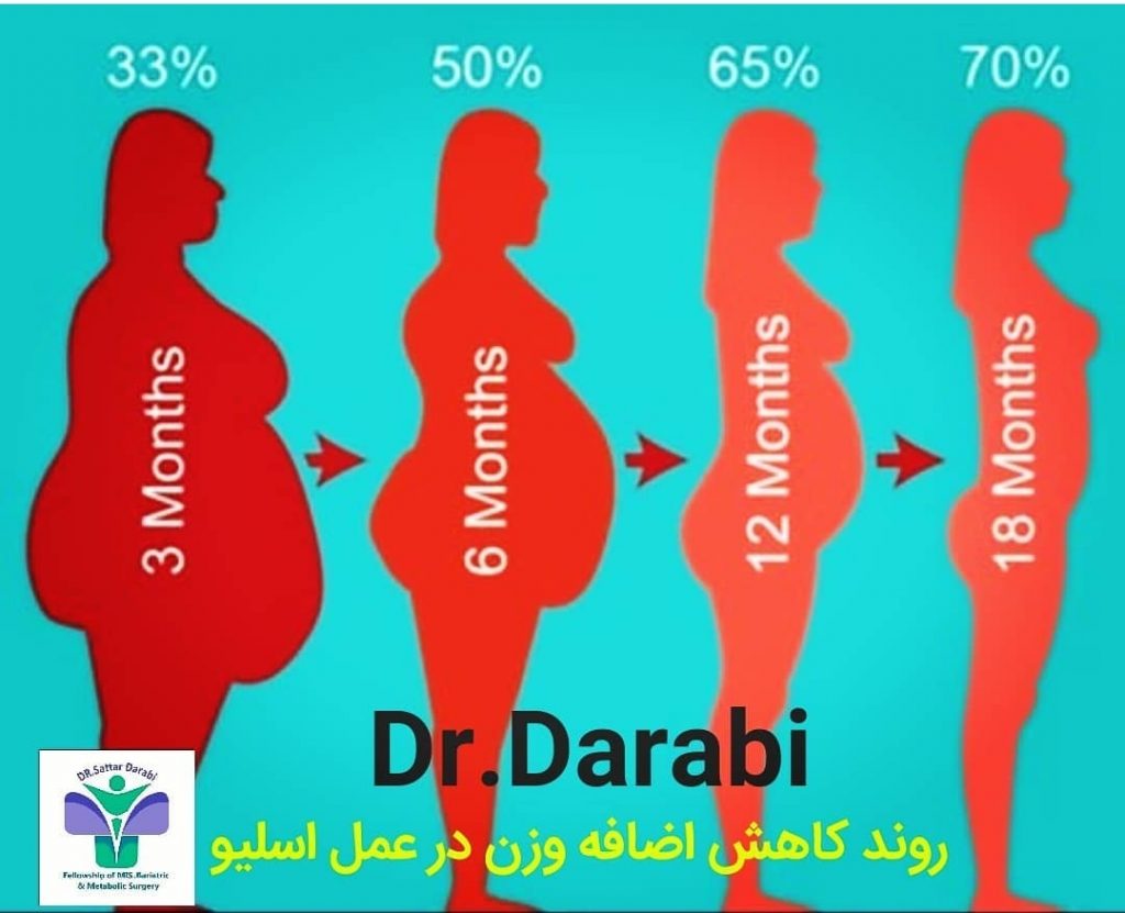 اسلیو