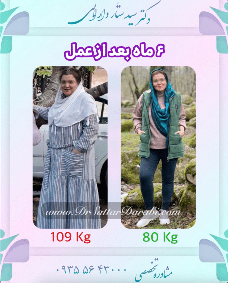 کاهش از ۱۰۹ کیلو به ۸۰ کیلو