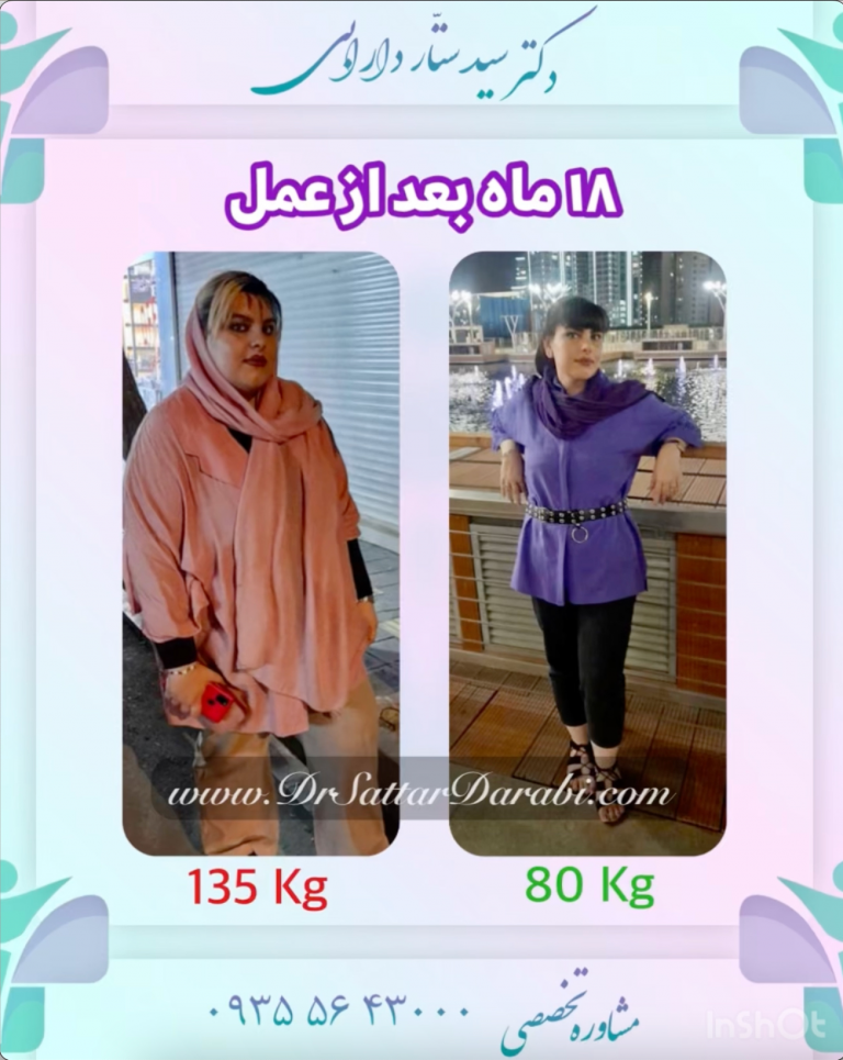 کاهش وزن ۱۳۵ کیلو به ۸۰ کیلو