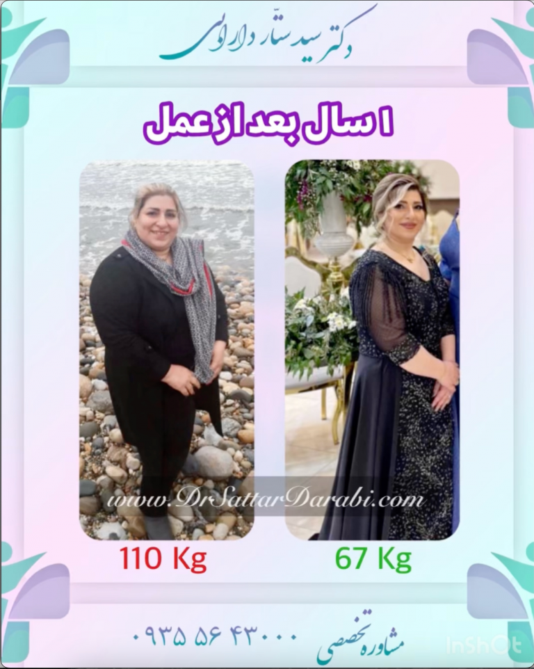 کاهش وزن 43 کیلوگرمی