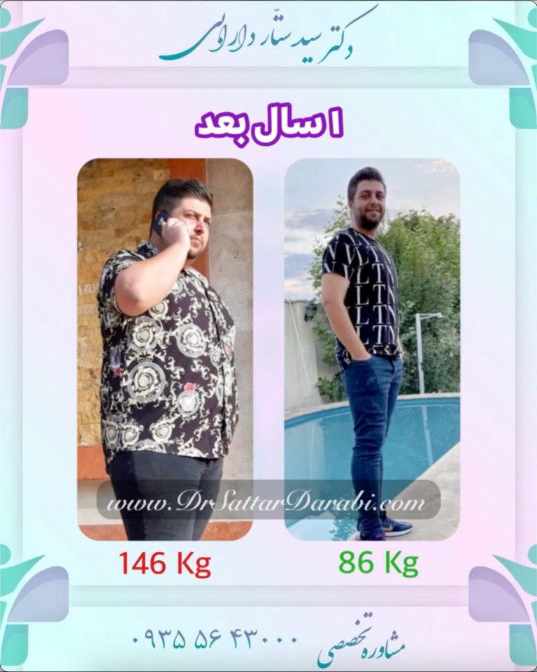 کاهش وزن از ۱۴۶ کیلو به ۸۶ کیلو