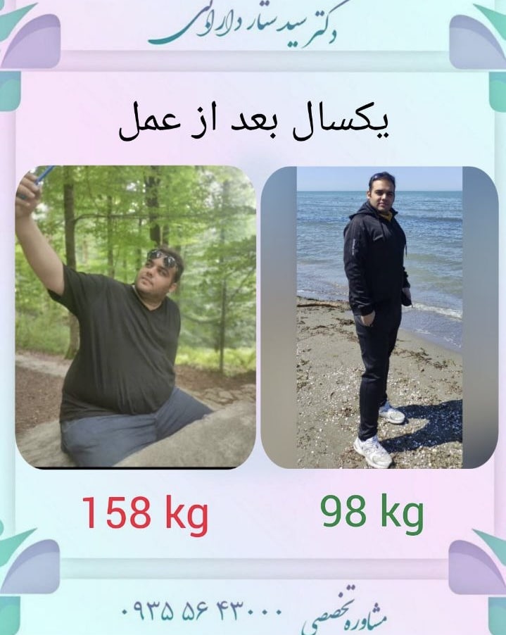 کاهش از 158 کیلو به 98 کیلو