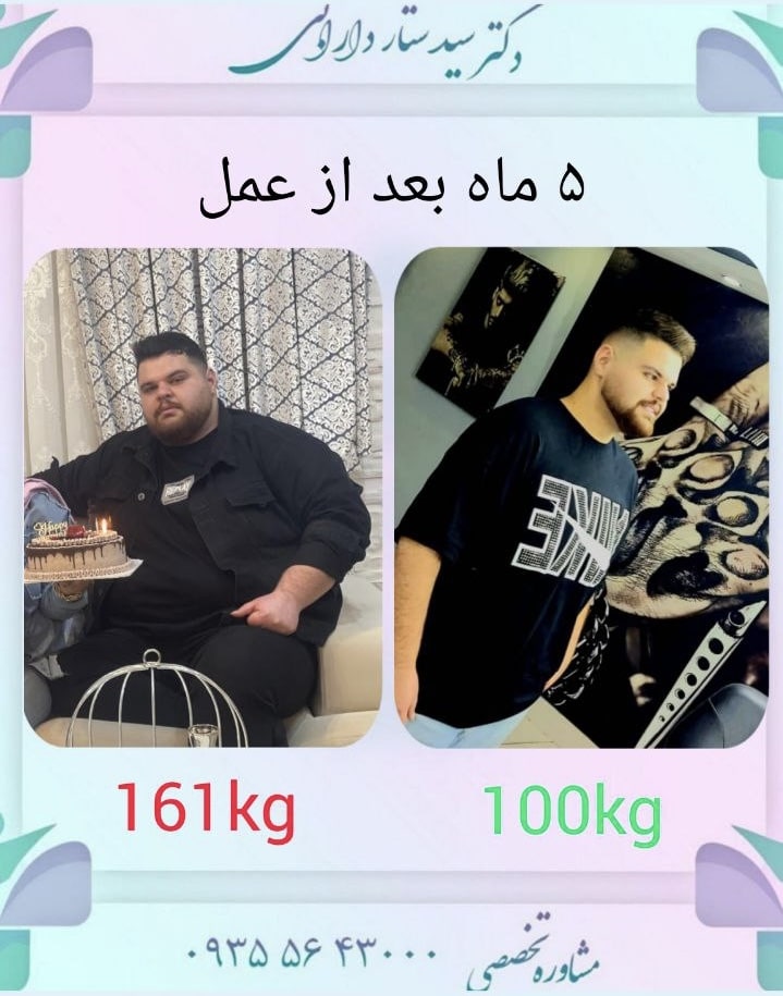 کاهش از 161 کیلو به 100 کیلو
