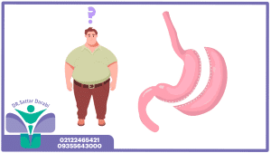 هزینه عمل اسلیو معده در تهران + شرایط ویژه و تضمینی