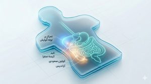 درد سمت راست شکم برای چیست