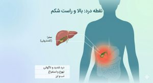 علائم سنگ کیسه صفرا