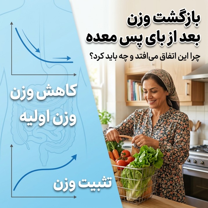 بازگشت وزن بعد از بای پس معده