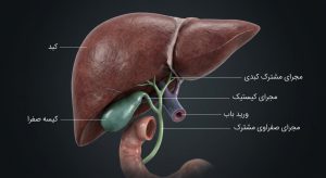 عوارض برداشتن کیسه صفرا در زنان