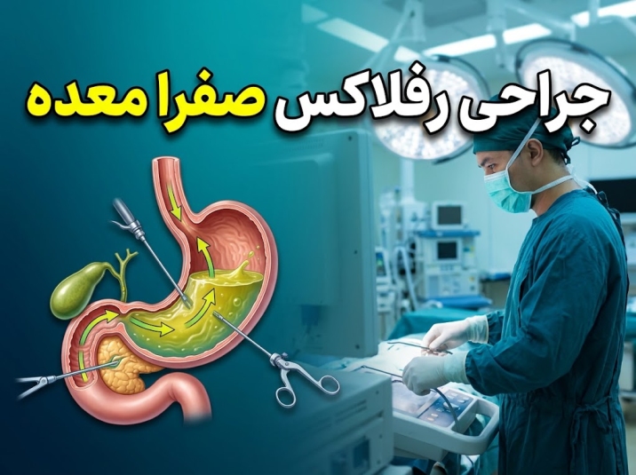 جراحی رفلاکس کیسه صفرا