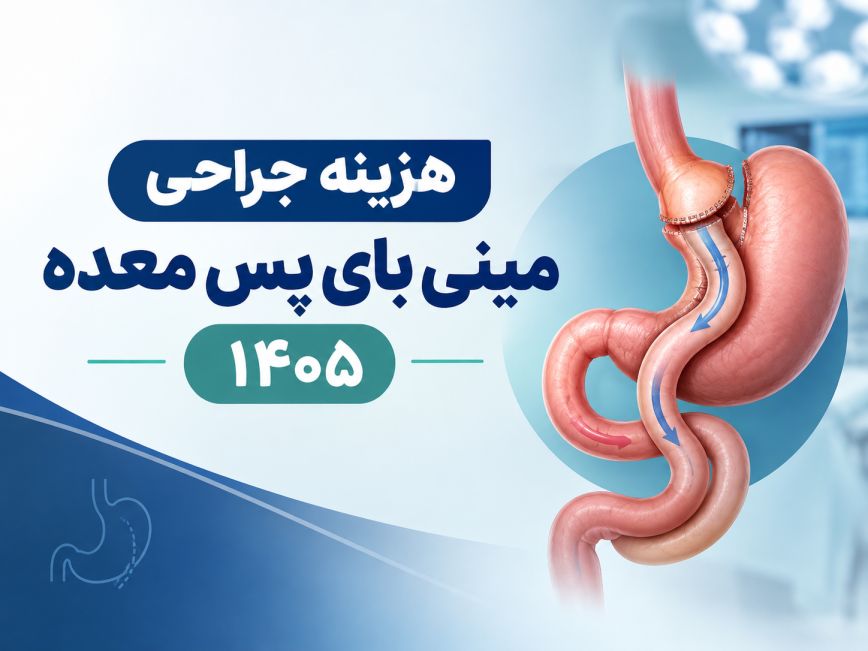 هزینه جراحی مینی بای پس معده